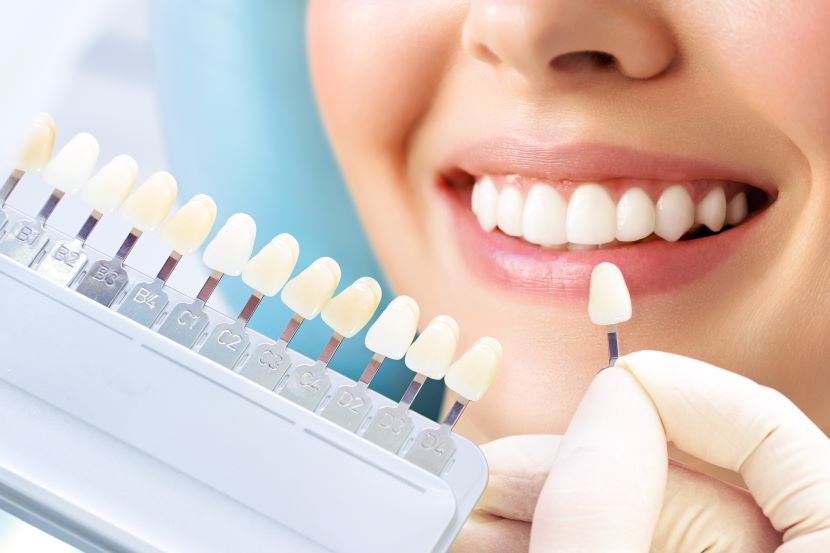 A woman looking at a tooth whitening shade guide.